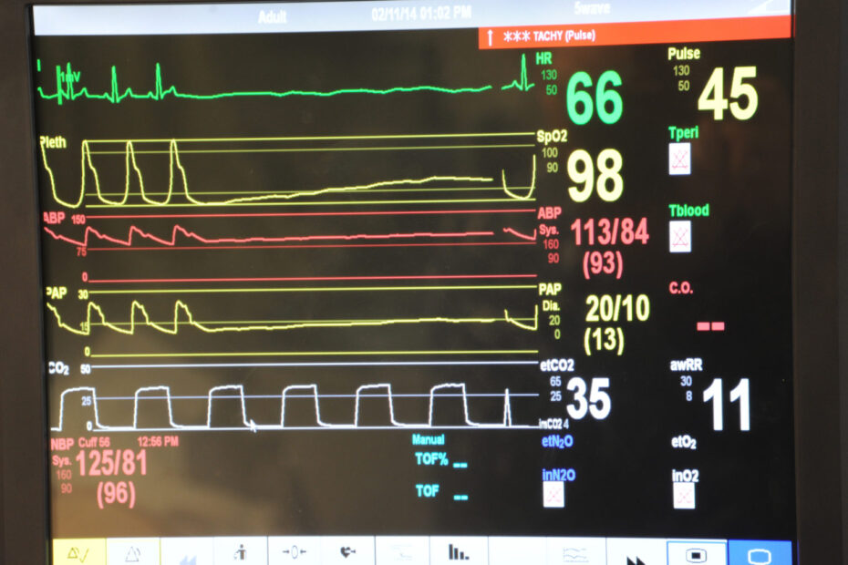 A vital signs monitor shows the heart rate, oxygen saturation and blood pressure on a simulated patient at Naval Hospital Pensacola.