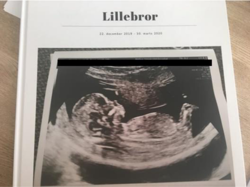A book cover with the title Lillebror and an image of a fetal ultrasound.
