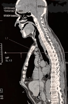 Image of a head and torso produced by a PET scan.